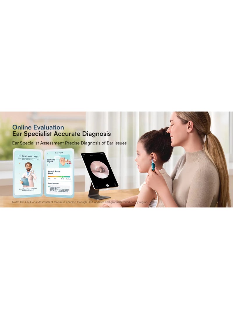 Bebird EarSight Ultra 2026 Visual Ear Cleaner Camera – 2K HD Endoscope with 5G WiFi, 60+ PCS Smart Earwax Removal Kit, Flexible Silicone Earpick, ENT Diagnostic Tools, Safe Reusable Ear Cleaning Set for Adults & Kids - Image 5